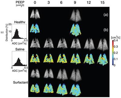 New Frontiers in Functional and Molecular Imaging of the Acutely Injured Lung: Pathophysiological Insights and Research Applications